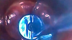 Endoscope POV: Test Tube Cock Urethral Insertion